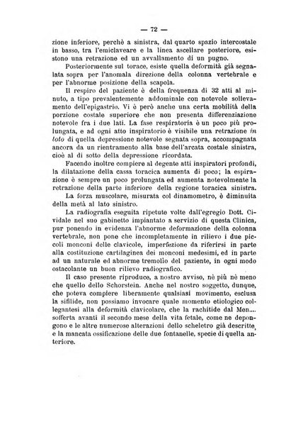 Archivio di ortopedia pubblicazione ufficiale del Pio istituto dei rachitici <1924-1950>