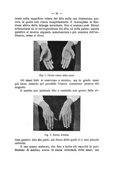 Archivio di ortopedia pubblicazione ufficiale del Pio istituto dei rachitici <1924-1950>