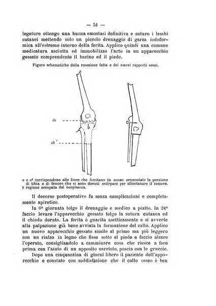 Archivio di ortopedia pubblicazione ufficiale del Pio istituto dei rachitici <1924-1950>