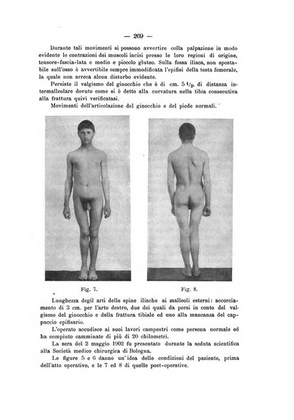 Archivio di ortopedia pubblicazione ufficiale del Pio istituto dei rachitici <1924-1950>