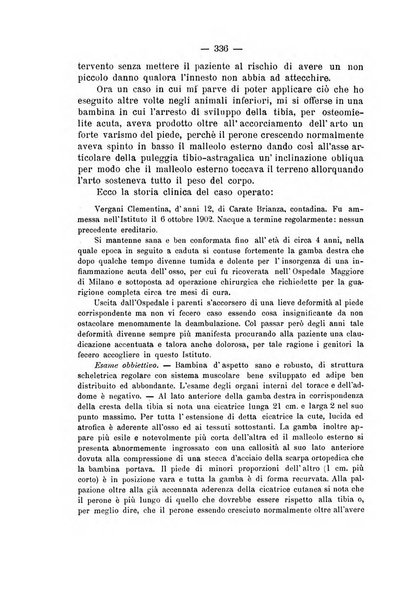 Archivio di ortopedia pubblicazione ufficiale del Pio istituto dei rachitici <1924-1950>