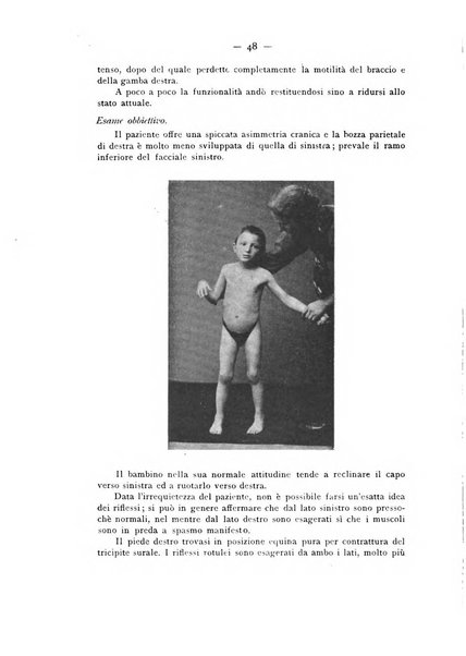 Archivio di ortopedia pubblicazione ufficiale del Pio istituto dei rachitici <1924-1950>