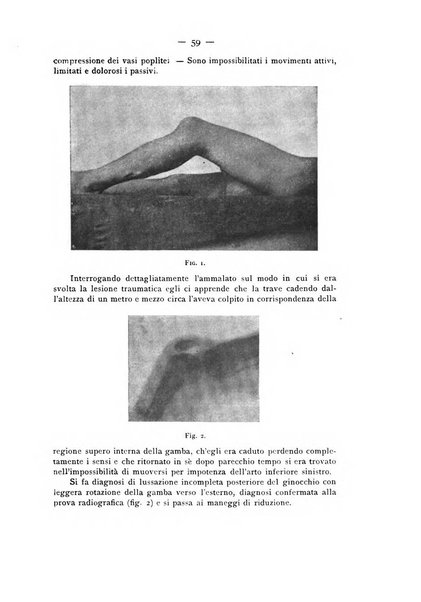 Archivio di ortopedia pubblicazione ufficiale del Pio istituto dei rachitici <1924-1950>