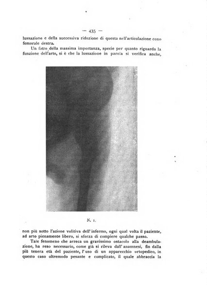 Archivio di ortopedia pubblicazione ufficiale del Pio istituto dei rachitici <1924-1950>