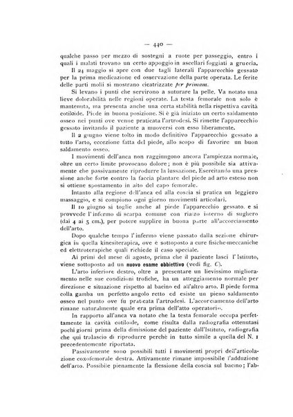 Archivio di ortopedia pubblicazione ufficiale del Pio istituto dei rachitici <1924-1950>