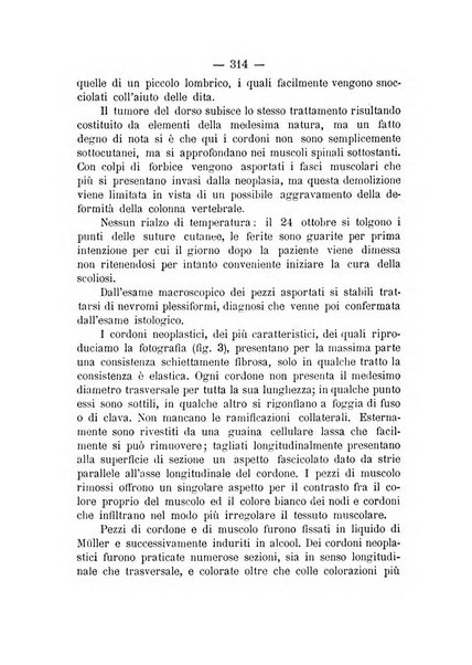 Archivio di ortopedia pubblicazione ufficiale del Pio istituto dei rachitici <1924-1950>