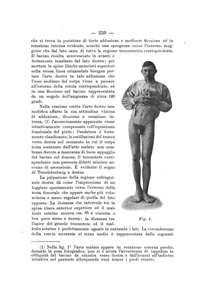 Archivio di ortopedia pubblicazione ufficiale del Pio istituto dei rachitici <1924-1950>