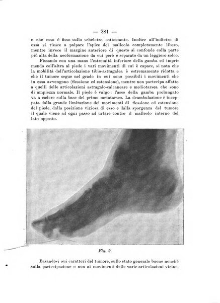 Archivio di ortopedia pubblicazione ufficiale del Pio istituto dei rachitici <1924-1950>