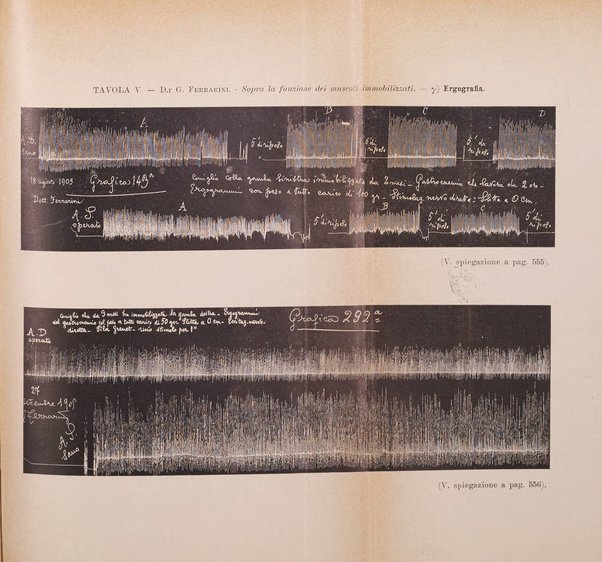 Archivio di ortopedia pubblicazione ufficiale del Pio istituto dei rachitici <1924-1950>