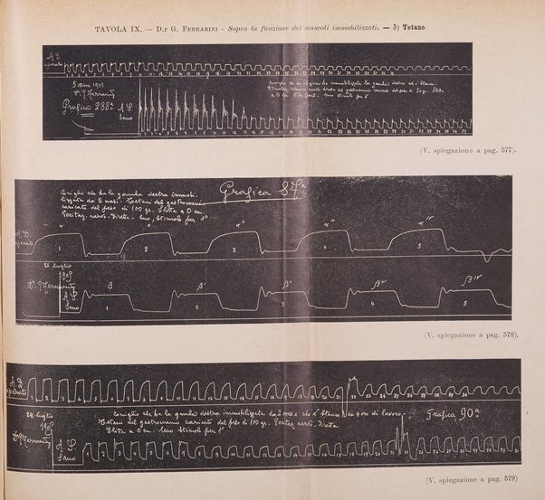 Archivio di ortopedia pubblicazione ufficiale del Pio istituto dei rachitici <1924-1950>