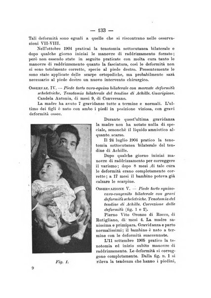 Archivio di ortopedia pubblicazione ufficiale del Pio istituto dei rachitici <1924-1950>