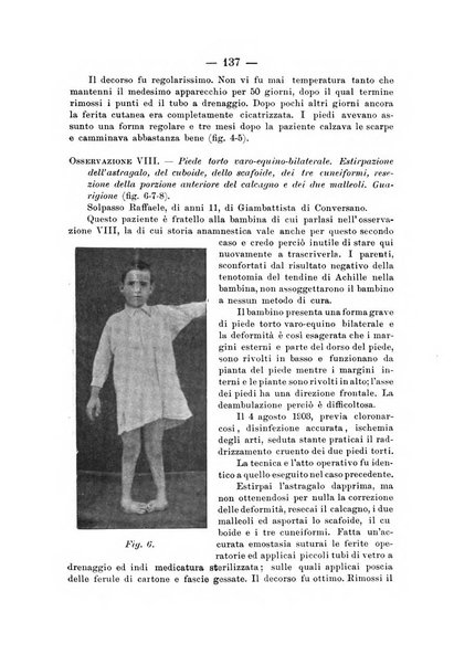 Archivio di ortopedia pubblicazione ufficiale del Pio istituto dei rachitici <1924-1950>