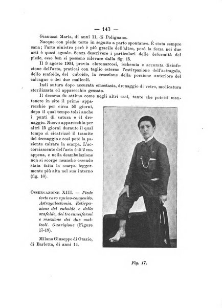 Archivio di ortopedia pubblicazione ufficiale del Pio istituto dei rachitici <1924-1950>