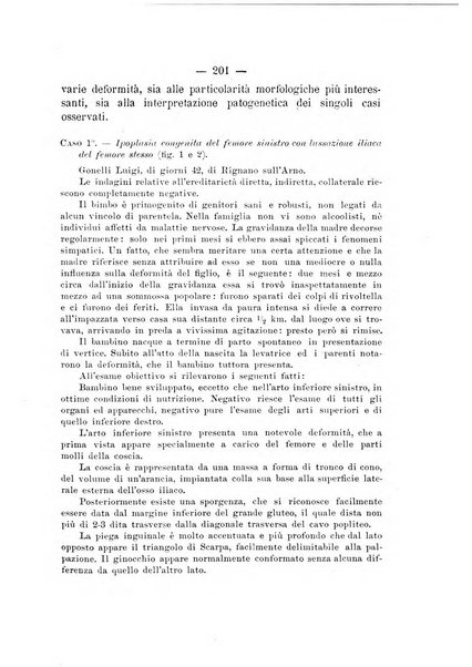 Archivio di ortopedia pubblicazione ufficiale del Pio istituto dei rachitici <1924-1950>