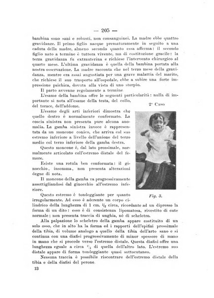 Archivio di ortopedia pubblicazione ufficiale del Pio istituto dei rachitici <1924-1950>