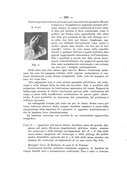 Archivio di ortopedia pubblicazione ufficiale del Pio istituto dei rachitici <1924-1950>