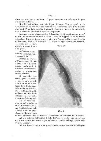 Archivio di ortopedia pubblicazione ufficiale del Pio istituto dei rachitici <1924-1950>