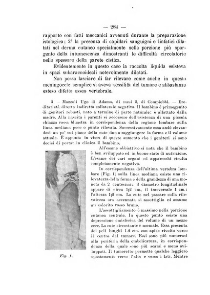 Archivio di ortopedia pubblicazione ufficiale del Pio istituto dei rachitici <1924-1950>