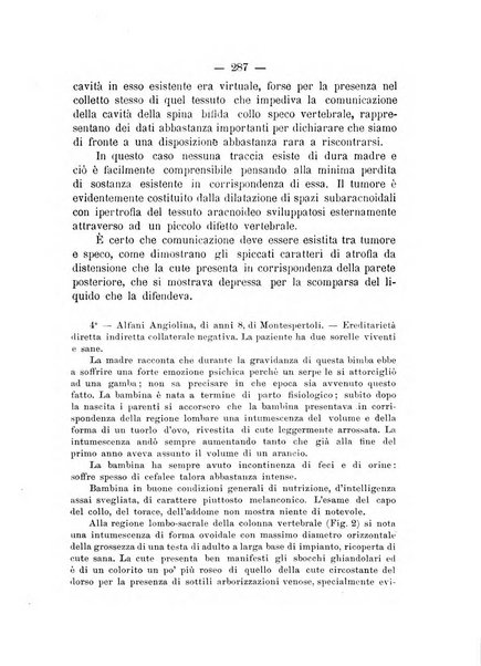 Archivio di ortopedia pubblicazione ufficiale del Pio istituto dei rachitici <1924-1950>