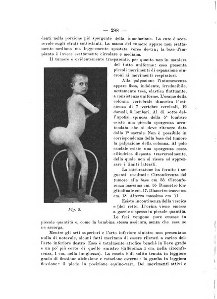 Archivio di ortopedia pubblicazione ufficiale del Pio istituto dei rachitici <1924-1950>