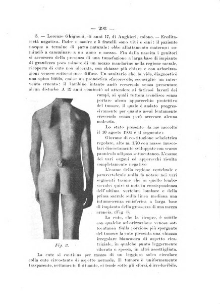 Archivio di ortopedia pubblicazione ufficiale del Pio istituto dei rachitici <1924-1950>