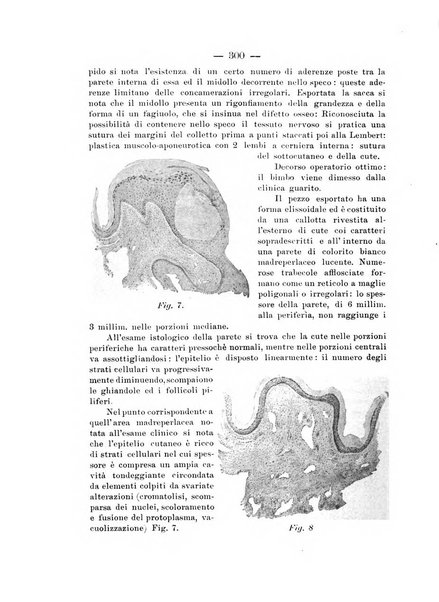 Archivio di ortopedia pubblicazione ufficiale del Pio istituto dei rachitici <1924-1950>