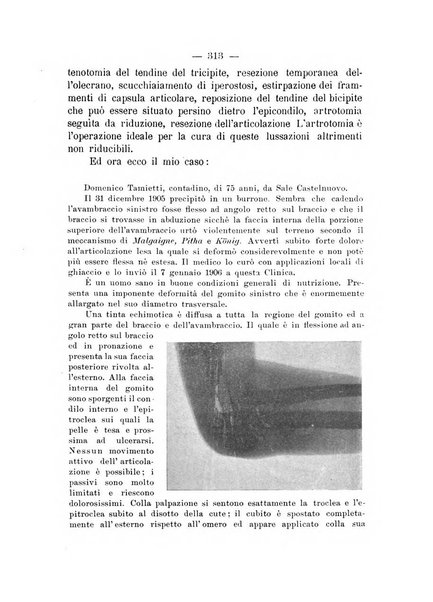 Archivio di ortopedia pubblicazione ufficiale del Pio istituto dei rachitici <1924-1950>