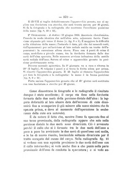 Archivio di ortopedia pubblicazione ufficiale del Pio istituto dei rachitici <1924-1950>