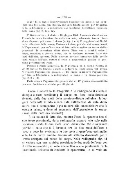 Archivio di ortopedia pubblicazione ufficiale del Pio istituto dei rachitici <1924-1950>