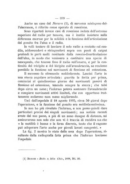 Archivio di ortopedia pubblicazione ufficiale del Pio istituto dei rachitici <1924-1950>