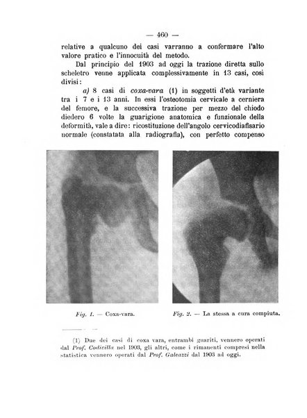 Archivio di ortopedia pubblicazione ufficiale del Pio istituto dei rachitici <1924-1950>