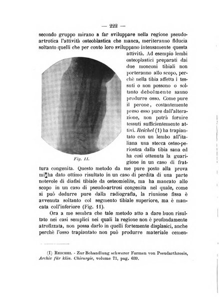 Archivio di ortopedia pubblicazione ufficiale del Pio istituto dei rachitici <1924-1950>