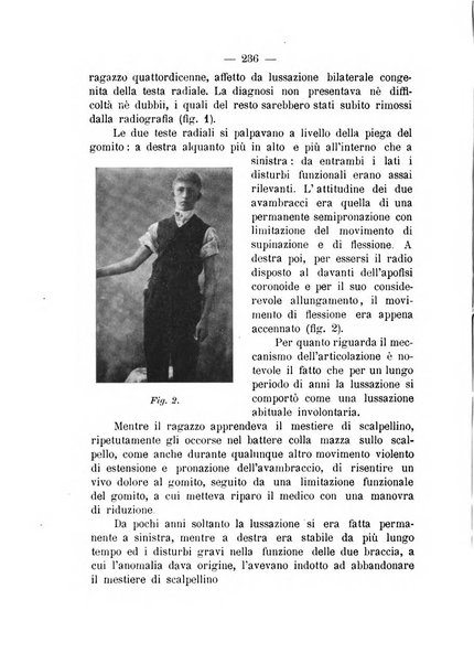 Archivio di ortopedia pubblicazione ufficiale del Pio istituto dei rachitici <1924-1950>