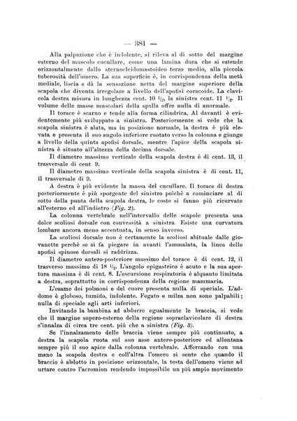 Archivio di ortopedia pubblicazione ufficiale del Pio istituto dei rachitici <1924-1950>