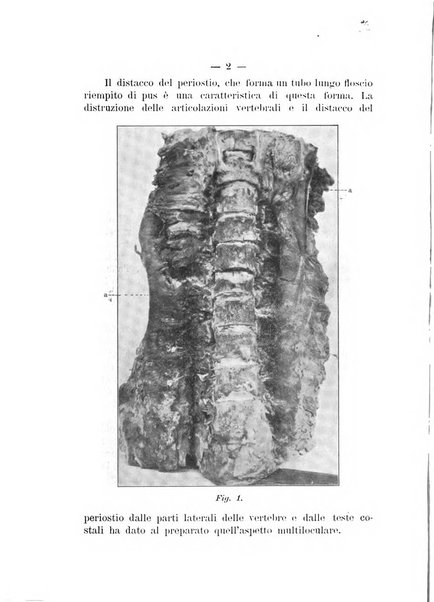 Archivio di ortopedia pubblicazione ufficiale del Pio istituto dei rachitici <1924-1950>