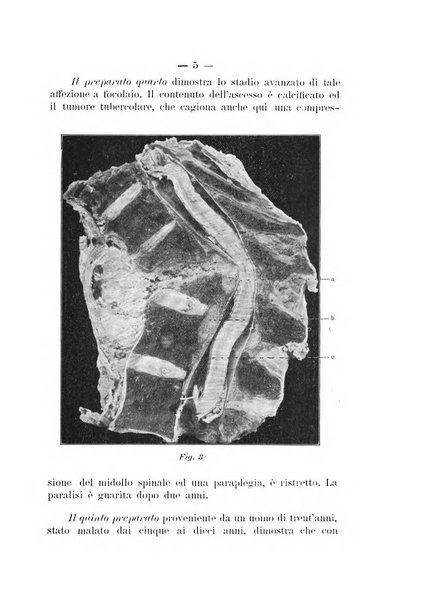 Archivio di ortopedia pubblicazione ufficiale del Pio istituto dei rachitici <1924-1950>