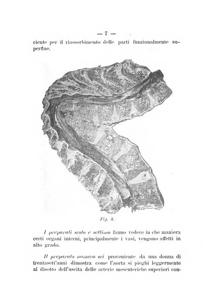 Archivio di ortopedia pubblicazione ufficiale del Pio istituto dei rachitici <1924-1950>