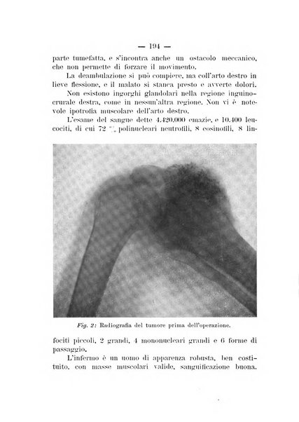 Archivio di ortopedia pubblicazione ufficiale del Pio istituto dei rachitici <1924-1950>