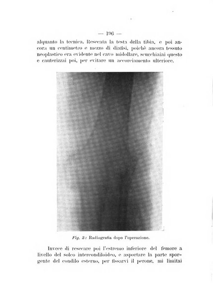 Archivio di ortopedia pubblicazione ufficiale del Pio istituto dei rachitici <1924-1950>