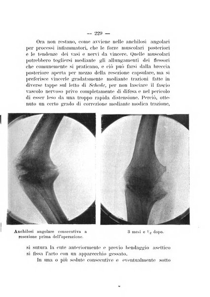 Archivio di ortopedia pubblicazione ufficiale del Pio istituto dei rachitici <1924-1950>