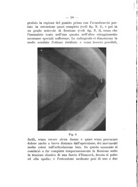 Archivio di ortopedia pubblicazione ufficiale del Pio istituto dei rachitici <1924-1950>