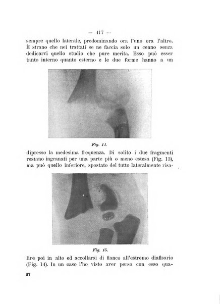 Archivio di ortopedia pubblicazione ufficiale del Pio istituto dei rachitici <1924-1950>