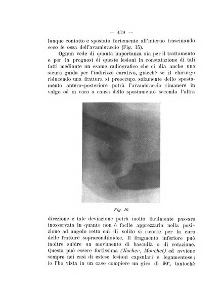 Archivio di ortopedia pubblicazione ufficiale del Pio istituto dei rachitici <1924-1950>