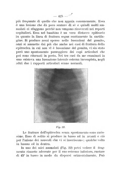 Archivio di ortopedia pubblicazione ufficiale del Pio istituto dei rachitici <1924-1950>