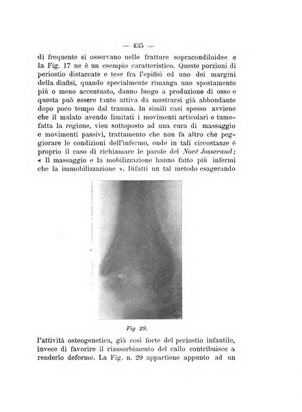 Archivio di ortopedia pubblicazione ufficiale del Pio istituto dei rachitici <1924-1950>