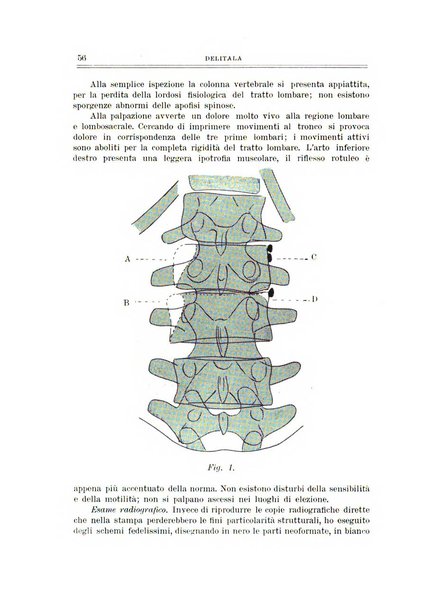 Archivio di ortopedia pubblicazione ufficiale del Pio istituto dei rachitici <1924-1950>