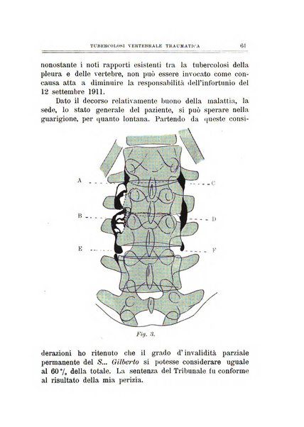 Archivio di ortopedia pubblicazione ufficiale del Pio istituto dei rachitici <1924-1950>