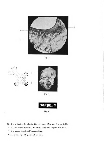 Archivio di ortopedia pubblicazione ufficiale del Pio istituto dei rachitici <1924-1950>