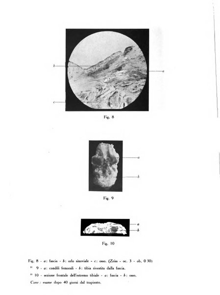 Archivio di ortopedia pubblicazione ufficiale del Pio istituto dei rachitici <1924-1950>