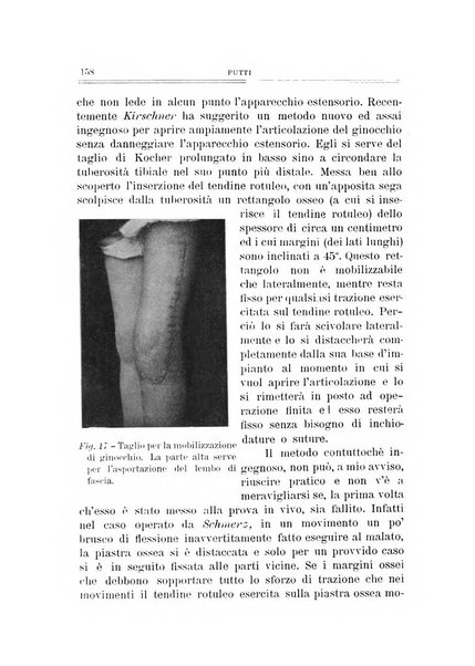 Archivio di ortopedia pubblicazione ufficiale del Pio istituto dei rachitici <1924-1950>